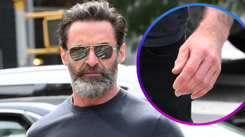 hugh jackman boyfriend